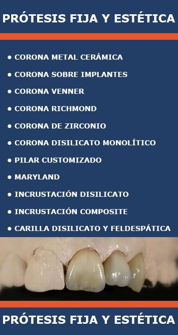 Servicio Protesis fija