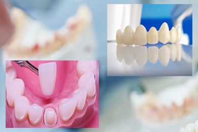 Materiales altamente estéticos